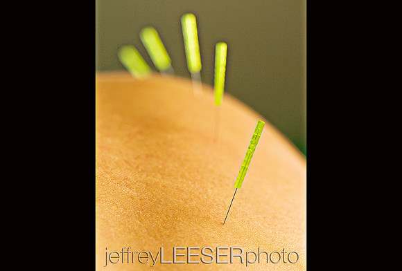HA 3-09 Acupuncture and Holistic Therapy